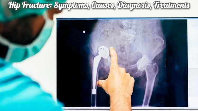 Hip Fracture: Symptoms, Causes, Diagnosis, Treatments
